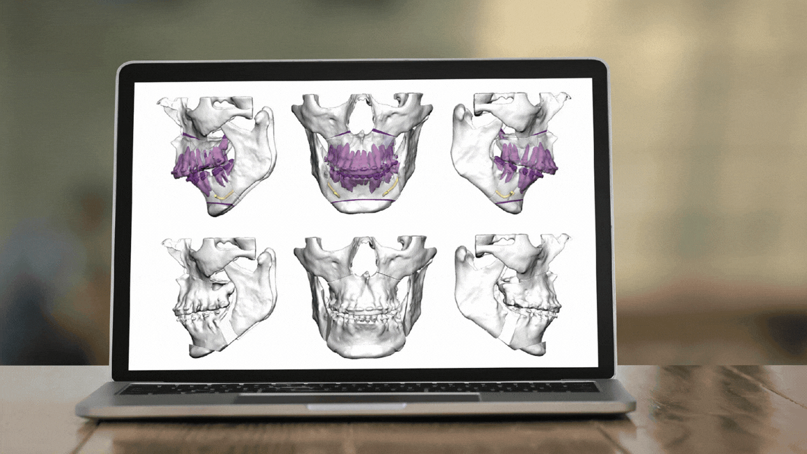 Curso Modular de Ortodoncia Quirúrgica y Cirugía Ortognática