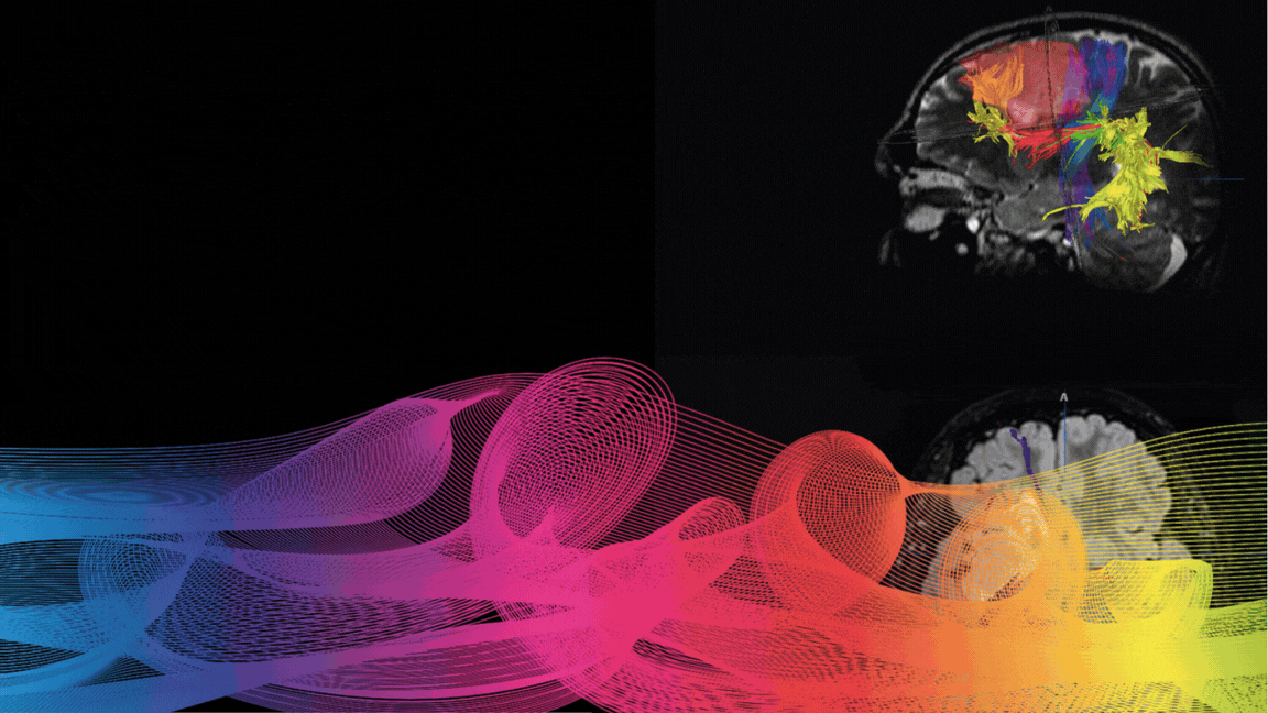 Neuropsychological Assistance Workshop. 2026 - 9th Mapping Course Bellvitge