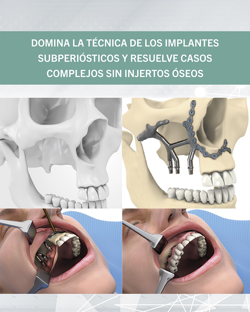 noticia-bustillo.jpg