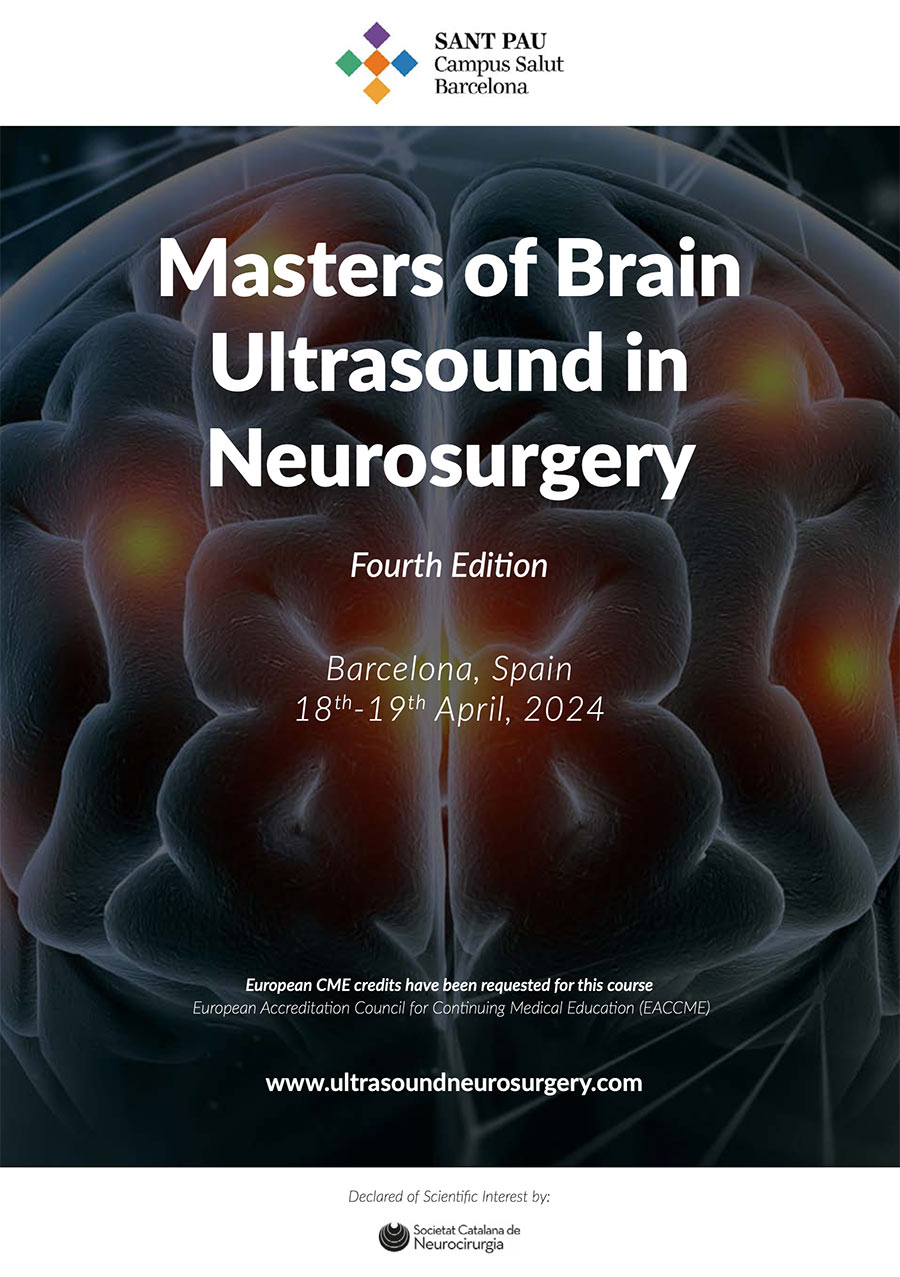 noticia ultrasound