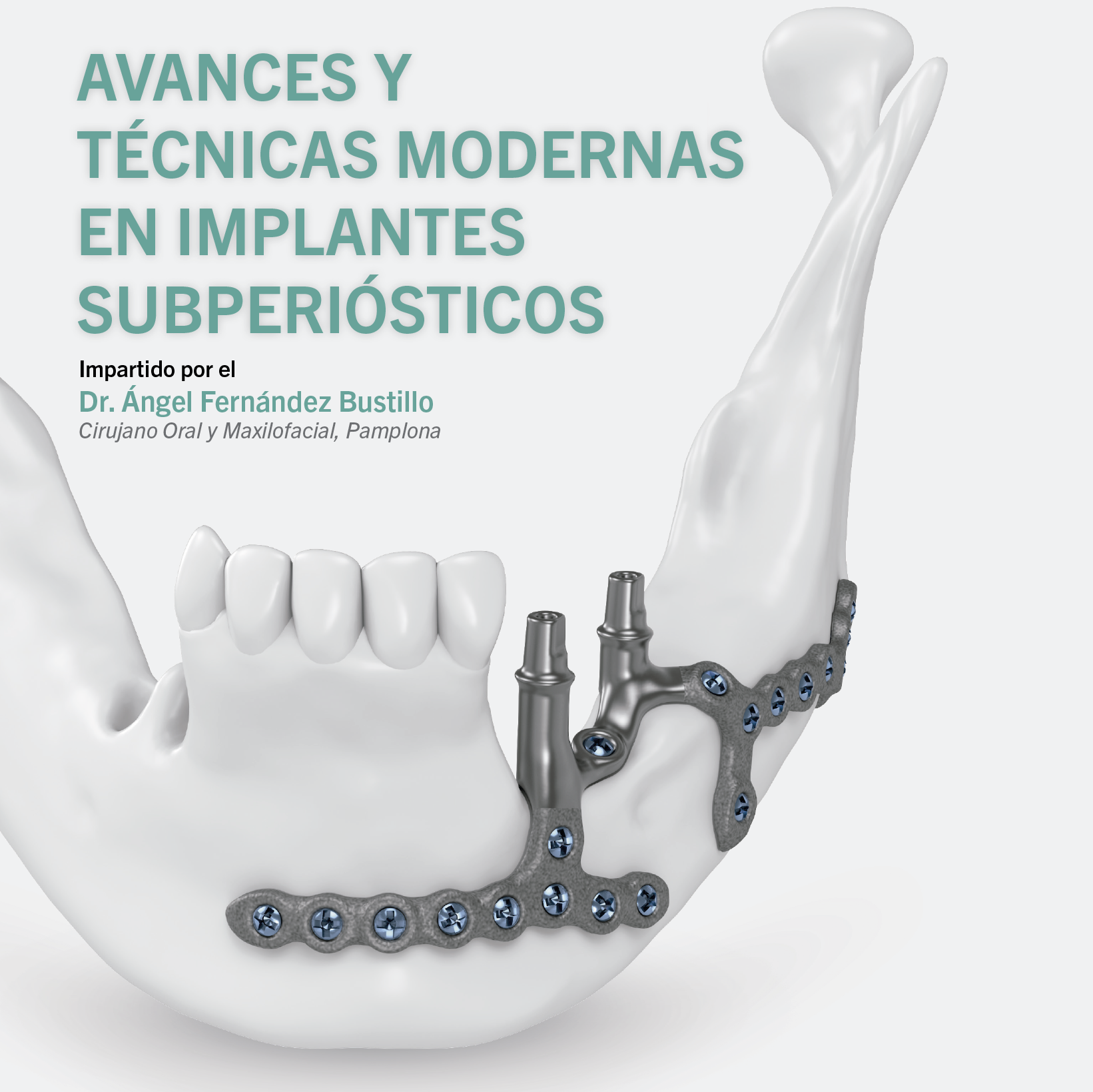 implantes subperiosticos web