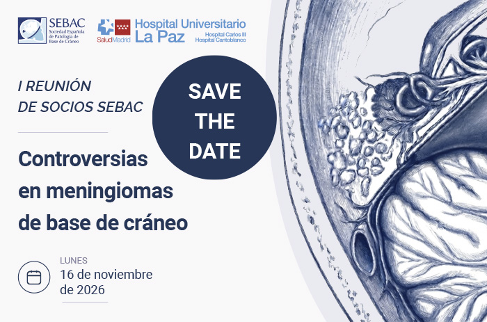 noticia meningiomas
