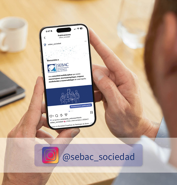 sebac-noticia-insta-2.jpg